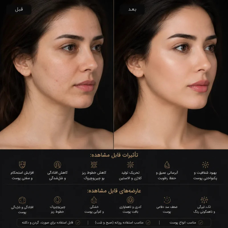 پک لیفت و سفتکننده پوست تراست