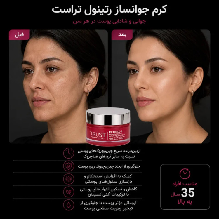 کرم جوانساز رتینول تراست